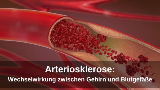 Arteriosklerose: Wechselwirkung zwischen Gehirn und Blutgefäße nachgewiesen