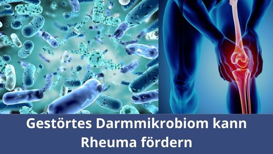 Gestörtes Darmmikrobiom kann Rheuma fördern
